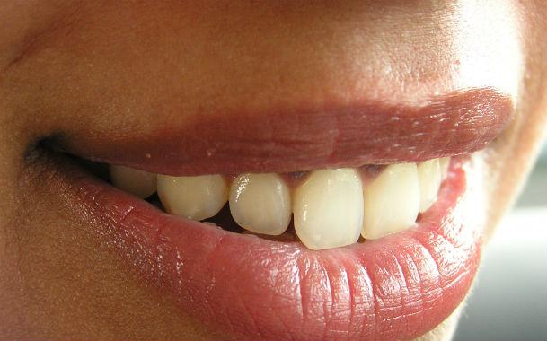 Os enxaguatórios bucais com óleos essenciais não causam manchas nos dentes, diz especialista (Foto: Free Images)