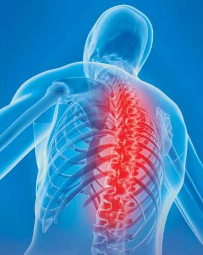 Espondilite anquilosante tem como principal sintoma a dor nas costas (Imagem: Divulgação)