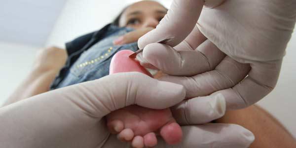 Teste do pezinho deve ser feito entre o 3º e o 5º dia de vida do recém-nascido (Foto: Bobby Fabisak/JC Imagem)