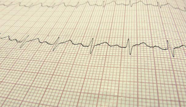 Uma boa consulta cardiológica e um eletrocardiograma bem interpretado podem diagnosticar mais de 90% dos problemas cardíacos, principalmente os congênitos (Foto: Free Images)