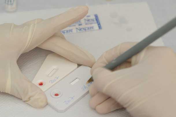 Imagem de testes rápidos de HIV e sífilis (Foto: Helia Scheppa / Acervo JC Imagem)