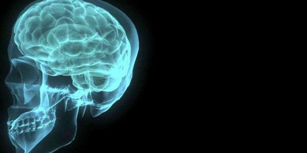 Imagem de raio-x de cérebro (Foto: Free Images)