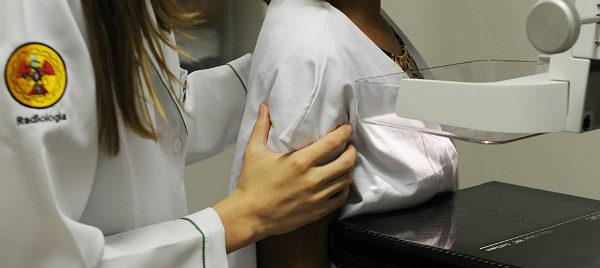 A mamografia reduz em cerca de 30% a mortalidade pelo câncer de mama (Foto: Guga Matos/JC Imagem)