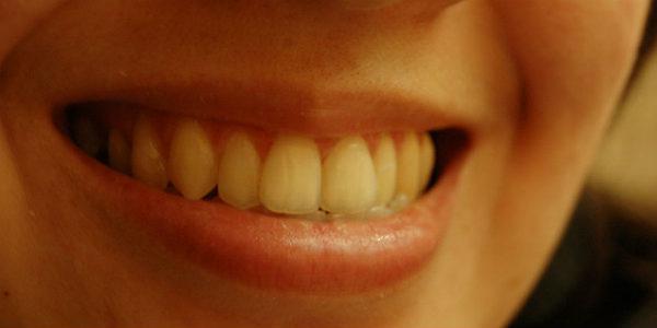 Imagem de dentes (Foto: Free Images)