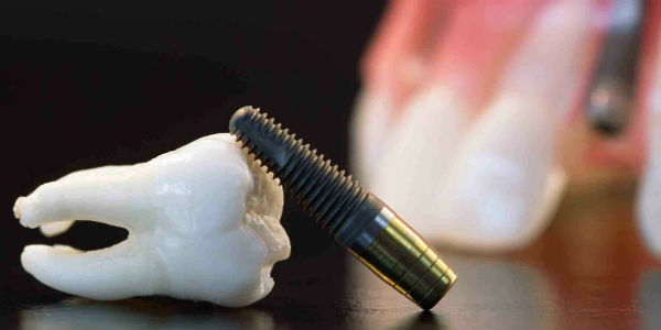 Imagem ilustrativa de dente (Foto: Divulgação/CDMF) 