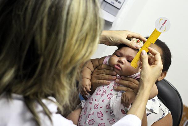 Bebês com microcefalia passaram por testes simples que fazem medida da visão e por procedimentos complexos, como exames de fundo de olho (Foto: Sérgio Bernardo/JC Imagem)
