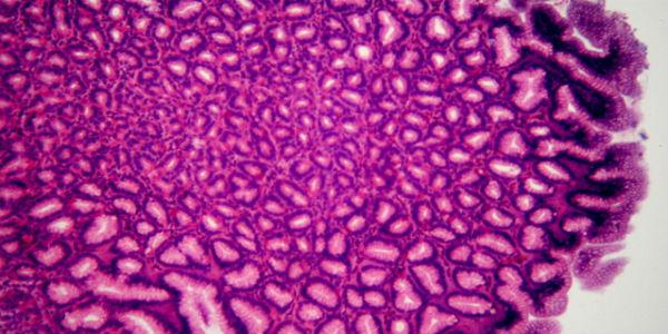 Imagem ilustrativa de estômago visto no microscópio (Foto: Free Images)