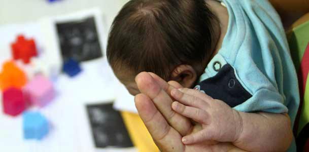 Entre os 153 bebês com o diagnóstico de microcefalia confirmado em Pernambuco, 12 foram submetidos a um novo exame e todos apresentaram existência do anticorpo IgM para zika no líquido cefalorraquidiano (Foto: Diego Nigro/JC Imagem)