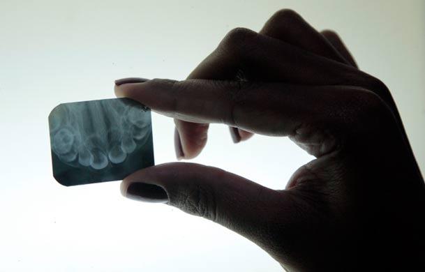 Pesquisadores analisam exames de radiografias odontológicas de crianças nascidas com microcefalia (Foto: Guga Matos/JC Imagem)