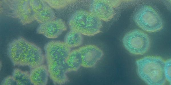 Imagem da bactéria vista em microscópio (Foto: Reprodução / Wikimedia Commons) 