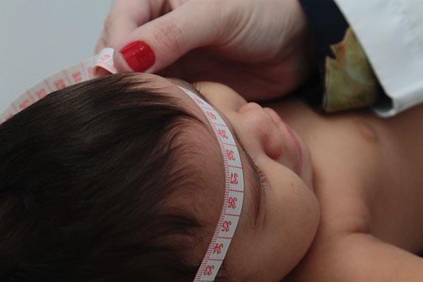 Em Pernambuco, de agosto de 2015 até 23 de julho de 2016, foram registrados 2.074 bebês que nasceram com suspeita de microcefalia (Foto: Guga Matos/JC Imagem)