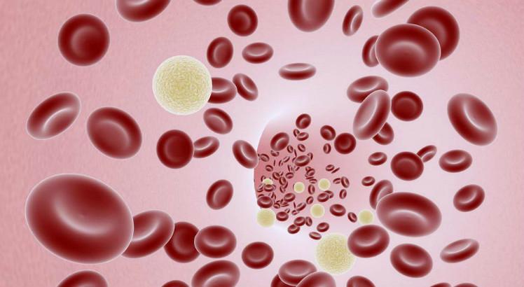 Leucemia linfocítica crônica é um câncer crônico no sangue e que geralmente acomete idosos (Imagem: Free Images)