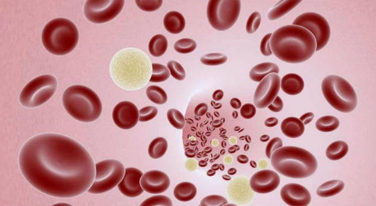 O tromboembolismo venoso (TEV) é caracterizado por coágulos sanguíneos que se produzem nas pernas e nos pulmões (Imagem: Free Images)