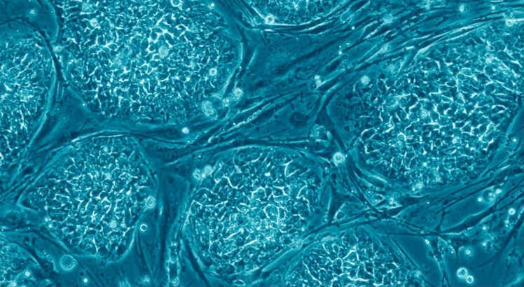 Em estudos com células-tronco tumorais, pesquisadores da Universidad de la República identificam reguladores com potencial de interferir no desenvolvimento de células cancerígenas (Imagem: Wikimedia Commons)