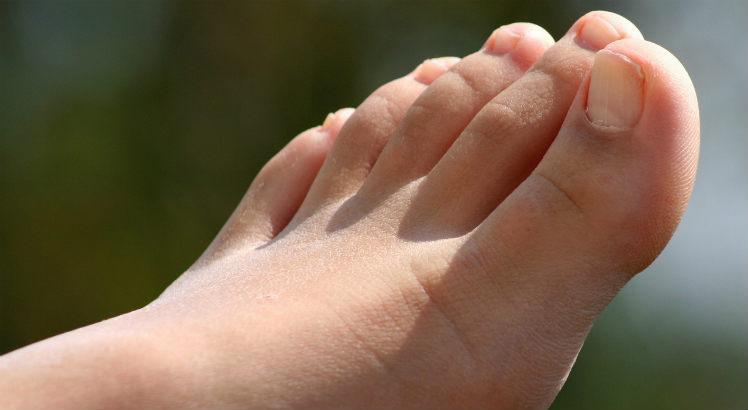 Formigamento nos pés é um dos primeiros sintomas da PAF, sigla para polineuropatia amiloidótica familiar (Foto ilustrativa: Free Images)