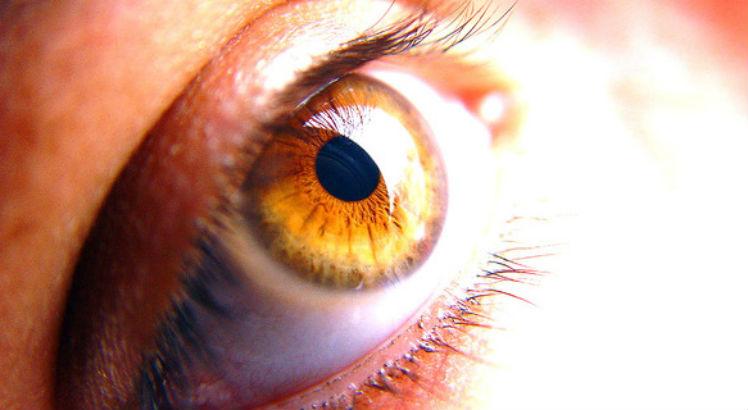 A artrite reumatoide estimula desenvolvimento de uma inflamação na esclera, o tecido fibroso que reveste o globo ocular. Nesses casos, podem ocorrer catarata, descolamento da retina e glaucoma (Foto: Free Images)