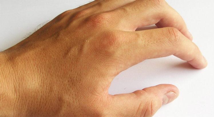 A hanseníase atinge principalmente a pele e nervos periféricos, podendo causar perda de sensibilidade em diversas regiões do corpo (Foto ilustrativa: Free Images)