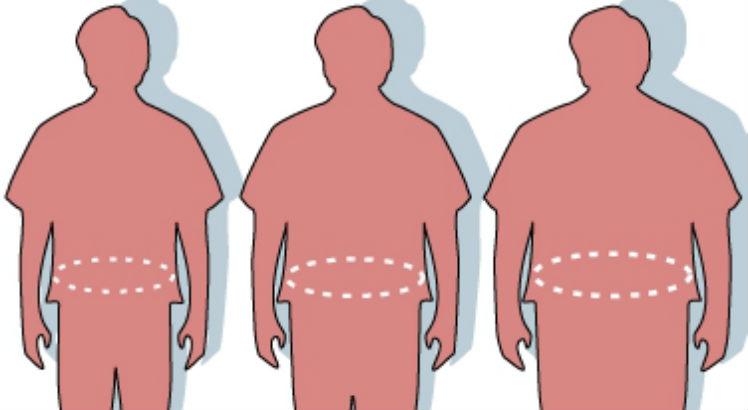 variáveis genéticas envolvidas nos processos de perda de peso, gasto energético e alteração na composição corporal em pacientes obesos submetidos à cirurgia bariátrica ou a dietas são o foco da pesquisa (Imagem: Wikimedia Commons)