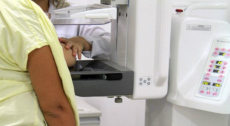 Com a mamografia, são identificadas lesões muitas vezes milimétricas na mama (Foto: Fernando da Hora/Acervo JC Imagem)