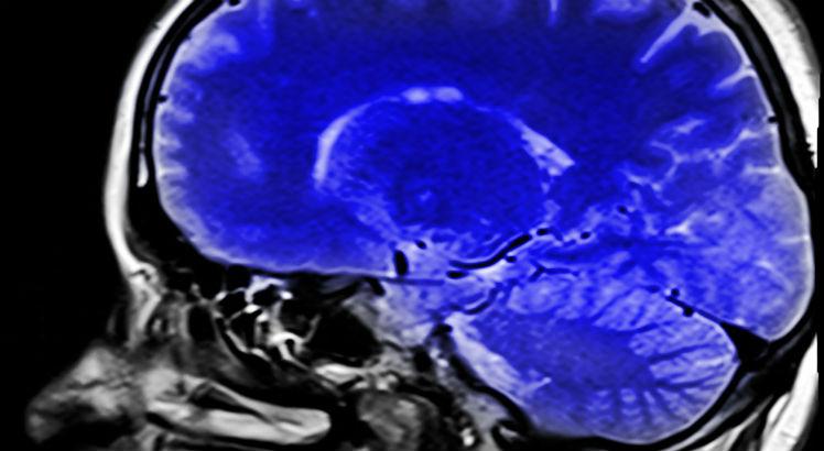 Procedimento é essencial na avaliação cerebral e da medula espinhal, atuando no diagnóstico e no tratamento do paciente (Foto ilustrativa: Pixabay)