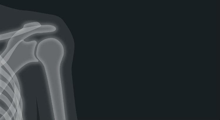 Lesões de ombro em jogadores de futebol e cuidados importantes com o ombro na musculação serão alguns dos temas debatidos (Foto ilustrativa: Pixabay)