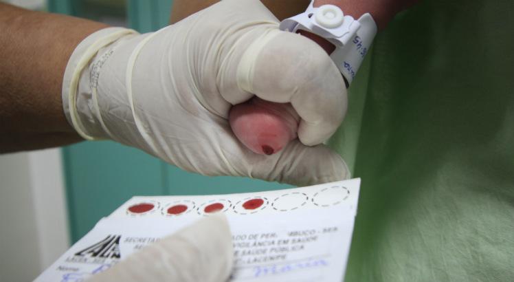 O teste é feito no pé, que é uma região bastante irrigada do corpo, o que facilita o acesso ao sangue para a coleta da amostra (Foto: Bobby Fabisak/JC Imagem)