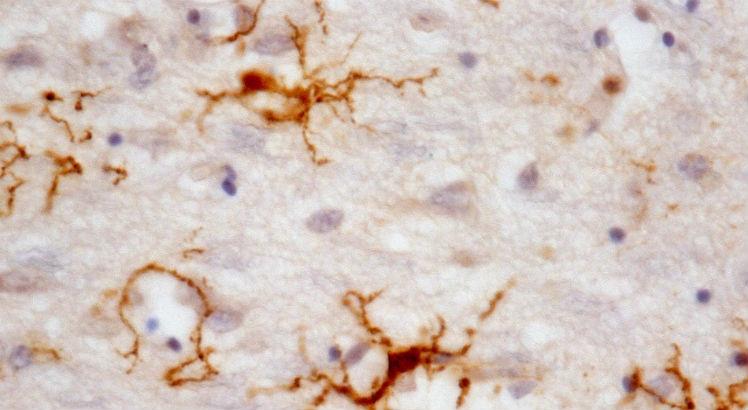 Estudo mostra que a micróglia humana tem muitos genes com expressão diferente da micróglia de camundongos, usada em estudos de doenças como Alzheimer (Foto: Divulgação)