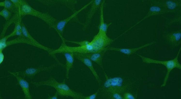 Diferença de expressão de hnRNPs pode levar à disfunção nos oligodendrócitos, uma das células da glia, importante para a atividade dos neurônios  (Imagem: Daniel Martins)