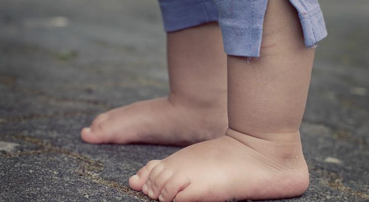 Uma criança obesa acumula risco de desenvolver mais doenças crônicas (Foto ilustrativa: Pixabay)