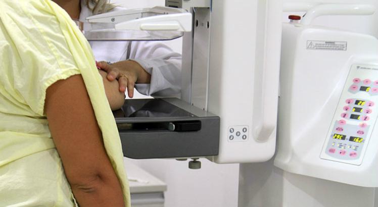 O pernambucano relata já ter ouvido falar sobre, pelo menos, nove tipos de tumor. O 1º é o câncer de mama, detectado pela mamografia (Foto: Fernando da Hora/Acervo JC Imagem) 