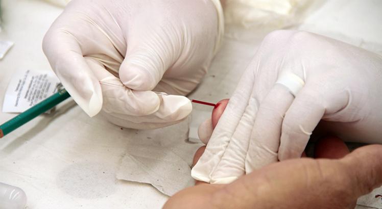 Diagnóstico precoce é importante para reduzir mortalidade por HIV/aids. A população também pode encontrar o teste em postos de saúde, nos Centros de Testagem e Aconselhamento e nas organizações não governamentais (Foto: SES/Divulgação)