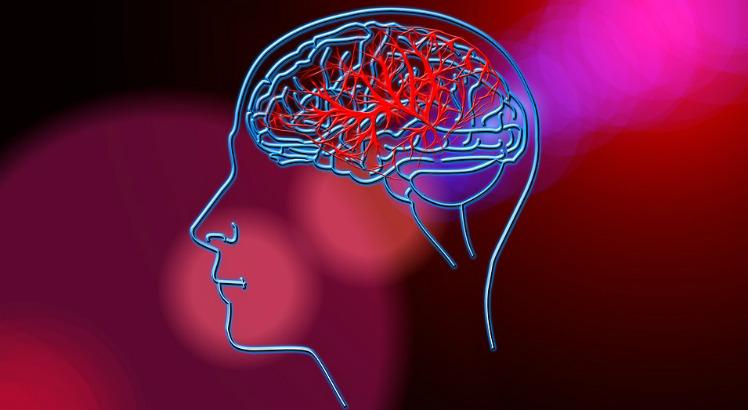 Entre os 172 casos suspeitos de doenças neuroinvasivas possivelmente associadas a arboviroses ao longo de 2 anos, 57 mostraram relação com a síndrome de Guillain-Barré (Imagem ilustrativa: Pixabay)