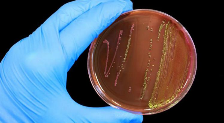 Especialista compara fungos resistentes a superbactérias (Foto ilustrativa: Freepik)