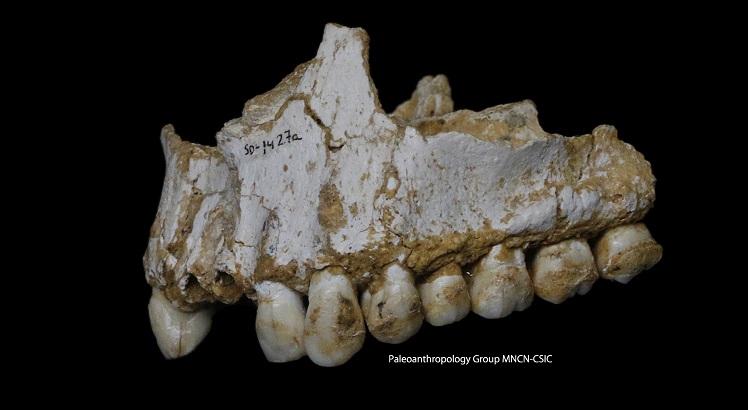 A mandíbula superior do Neanderthal de El Sidron, encontrada no que é hoje a Espanha, possui um depósito de cálculo dental visível no molar traseiro. Foto: AFP/CSIC