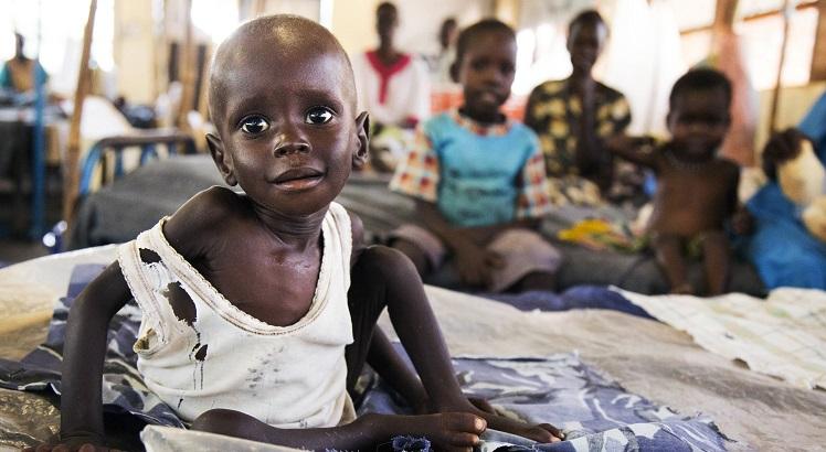 Aleo Tong, que sofre de disnutrição severa, está num hospital dos Médicos Sem Fronteiras, no Sudão do Sul. AFP PHOTO / ALBERT GONZALEZ FARRAN
