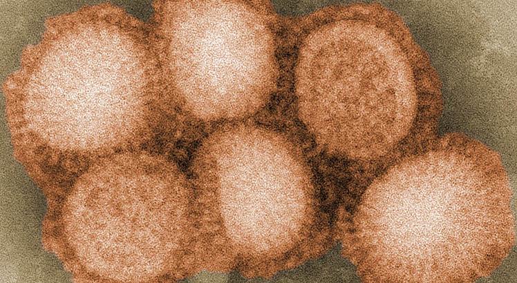 Vírus da gripe (Wikimedia Commons)