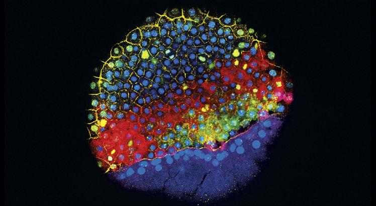 Um embrião de peixe-zebra em um estágio inicial de desenvolvimento. Marcadores fluorescentes destacam as células que expressam genes que ajudam a determinar o tipo de célula que elas se tornarão. (JEFFREY FARRELL, SCHIER LAB / HARVARD UNIVERSITY)