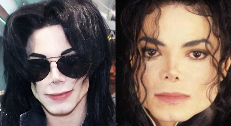 Argentino gasta R$ 110 em cirurgias e se torna 'clone' de Michael Jackson. Foto: Reprodução/Instagram