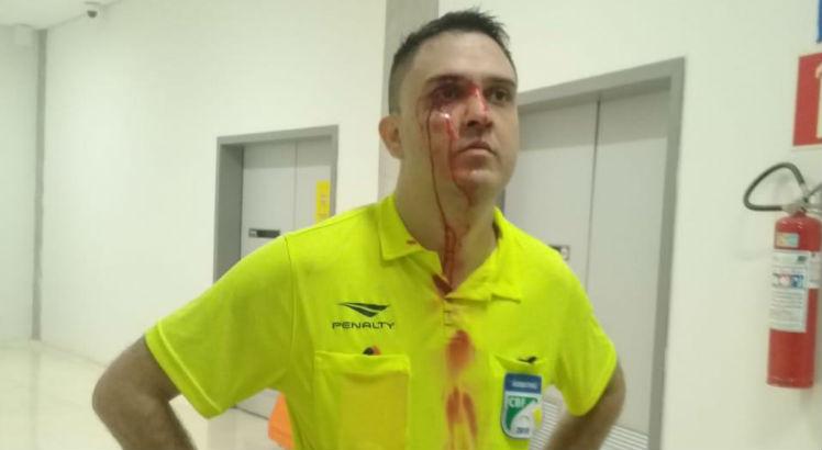 Tiago Nascimento foi perseguido no corredor, na saída do campo, depois da final entre Santa Cruz e Porto, na Arena de Pernambuco. Foto: Cortesia/Associação Nacional dos Árbitros de Futebol